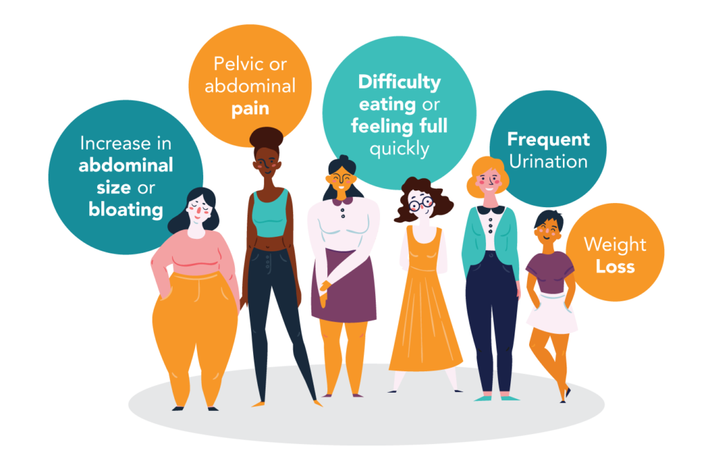 Graphic showing the different types of ovarian cancer symptoms like abdominal size or bloating, pelvic pain, feeling full, frequent urination and weight loss.